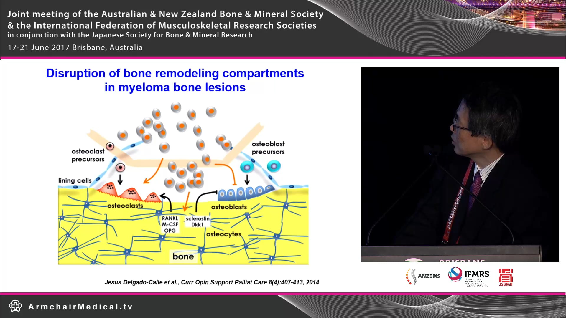 Novel targets of treatment for myeloma-bone interaction Prof Masahiro Abe