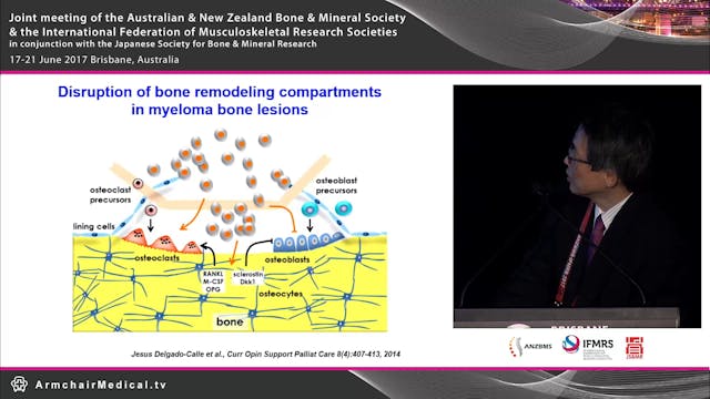 Novel targets of treatment for myelom...