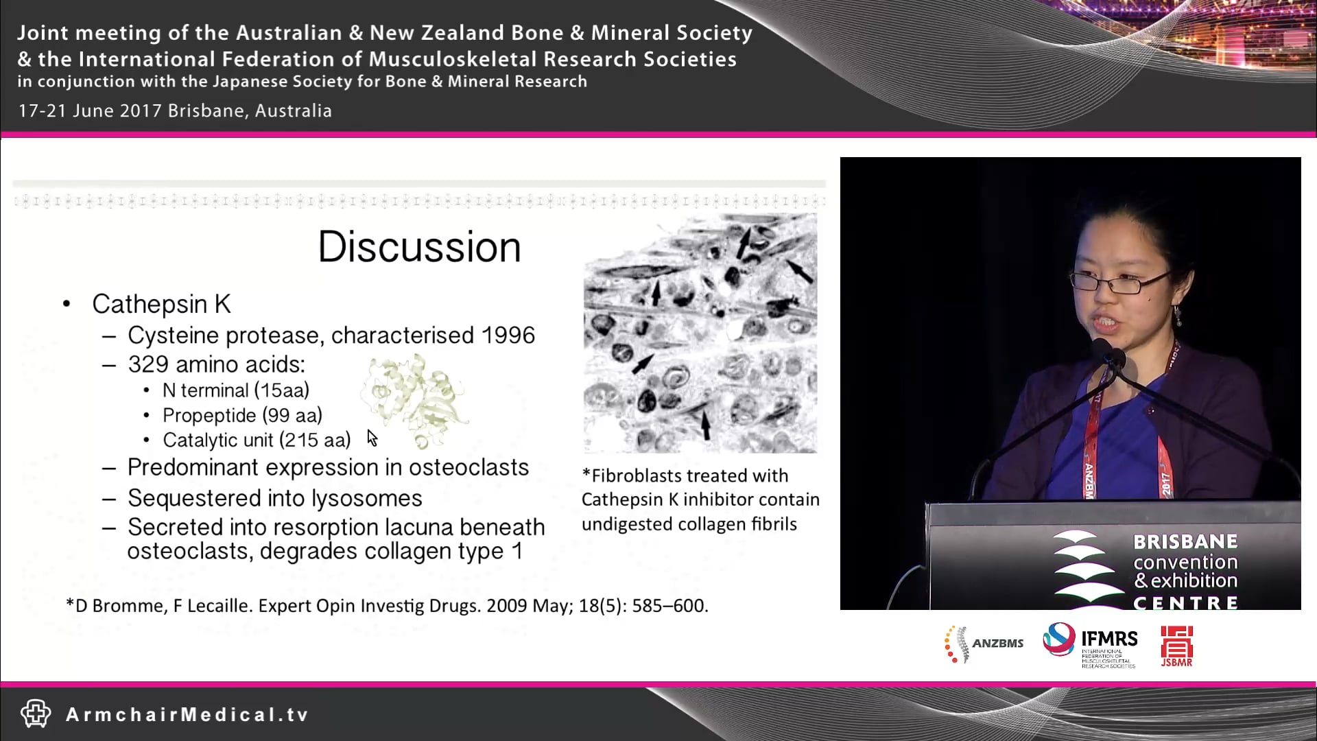 A homozygous variant in CTSK bilateral atypical femoral fracture without clinical features of pyknodysostosis Sue Lynn Lau