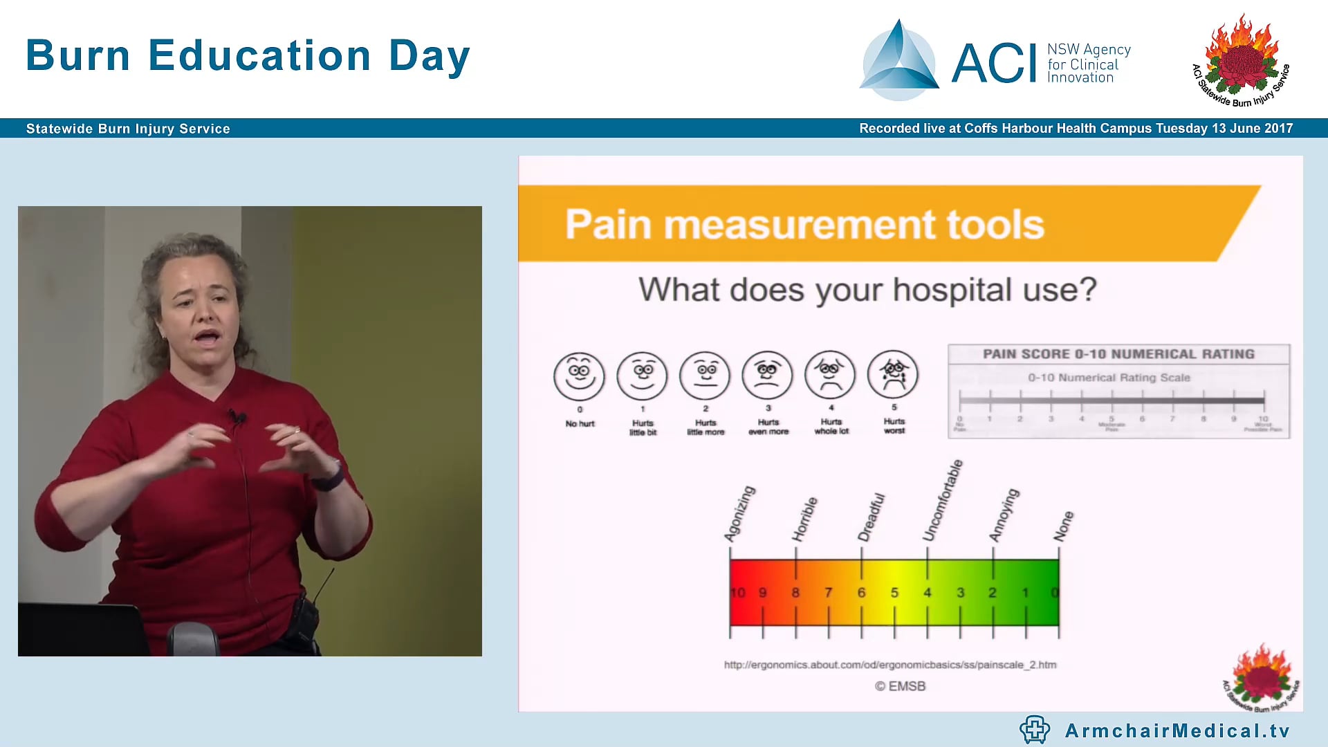 Burn Wound Management Pain, Mechanisms, Blisters, Wound Management, Dressing Products, Dressing Techniques Siobhan Connolly, Burn Education Manager ACI SBIS; Burn Nurse