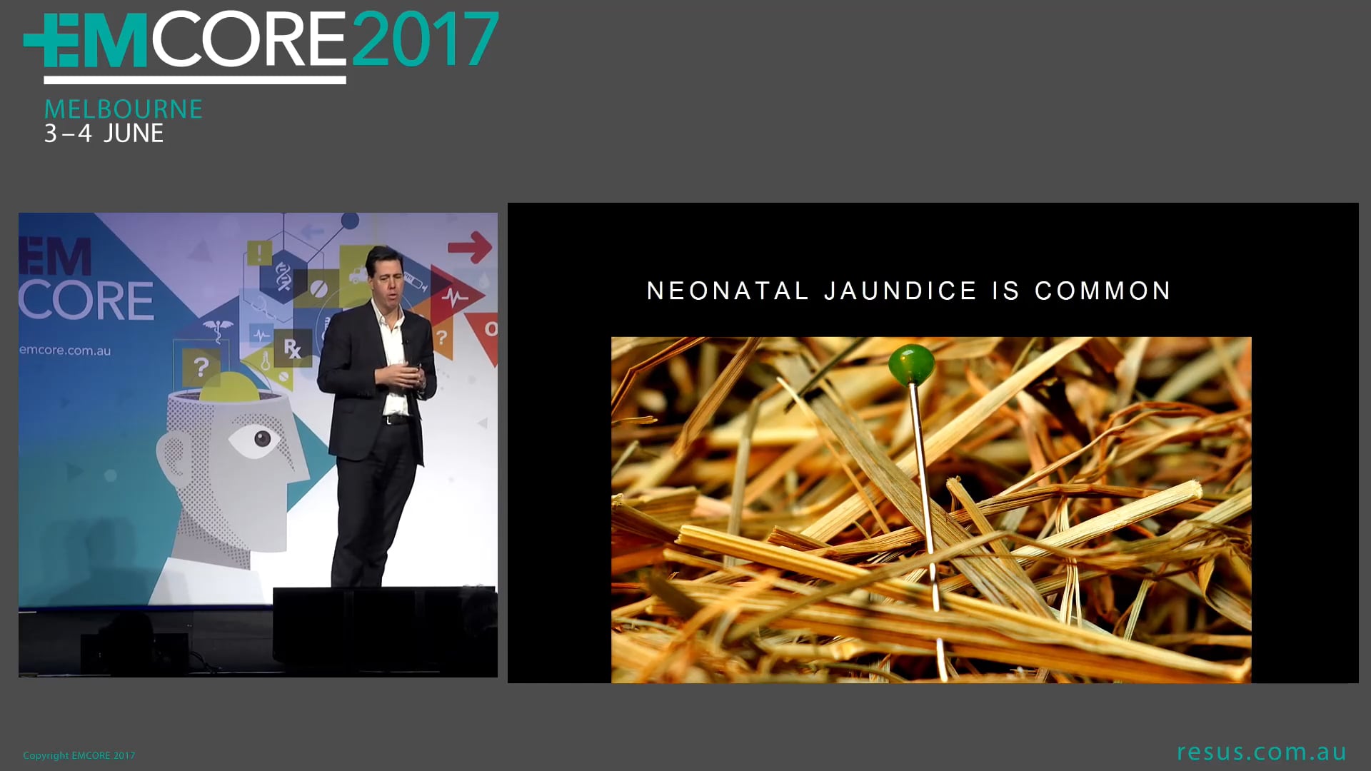 Jaundice in the neonate Dr James Edwards Co-Director ED RPA Sydney