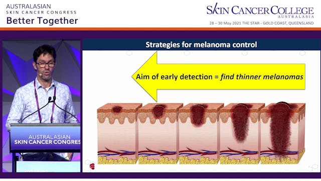 Skin cancer risk prediction tools - W...