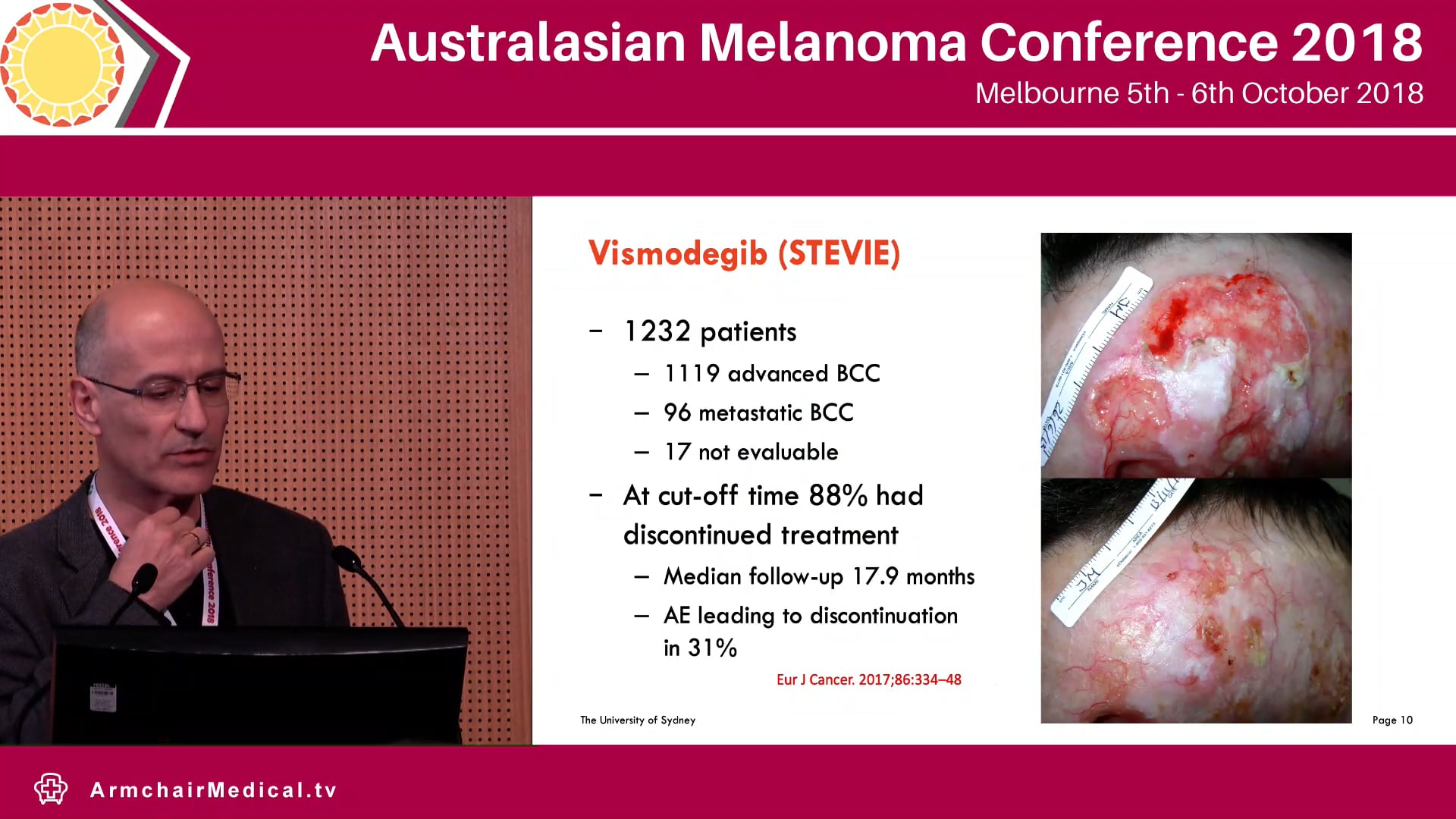 Hedgehog pathway inhibitors for BCC Pablo Fernandez-Penas 