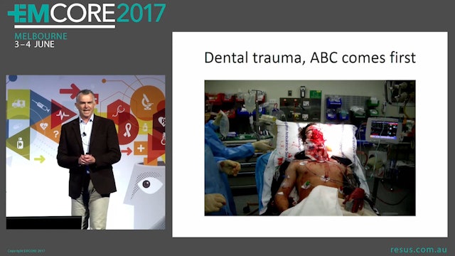 Dental Trauma Assoc Prof Alastair Meyer Director EM Casey Hospital