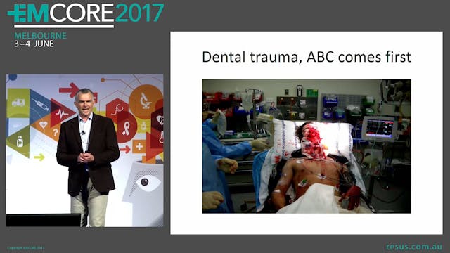 Dental Trauma Assoc Prof Alastair Mey...