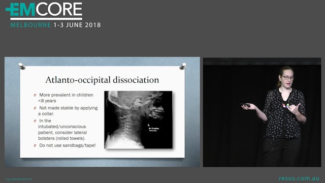C-spine clearance in children Dr Claire Wilkin