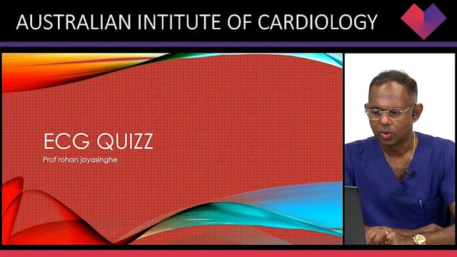 ECG Quiz Prof Rohan Jayasinghe