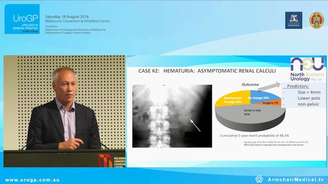 Nephrolithiasis Case based primary ca...