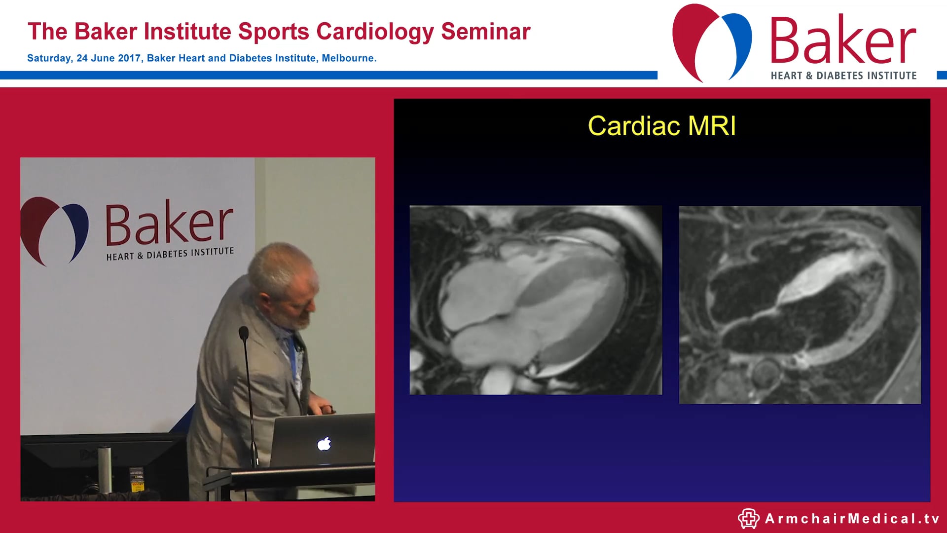 Case: Chest pain in an athlete Assoc Prof David Prior