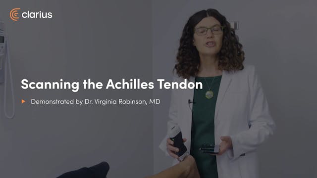Scanning the Achilles Tendon