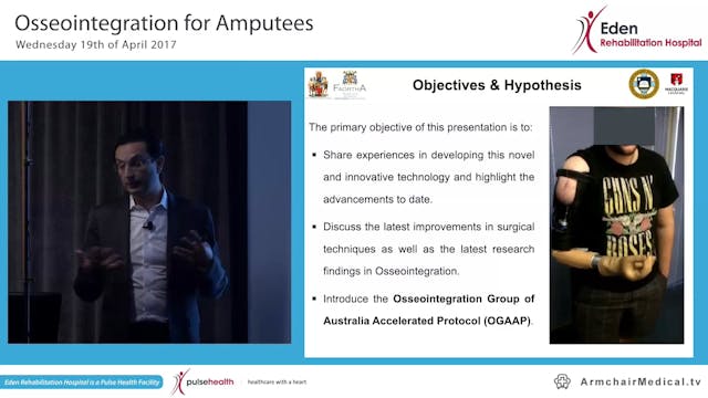 1 Osseointergration for Amputees Asso...