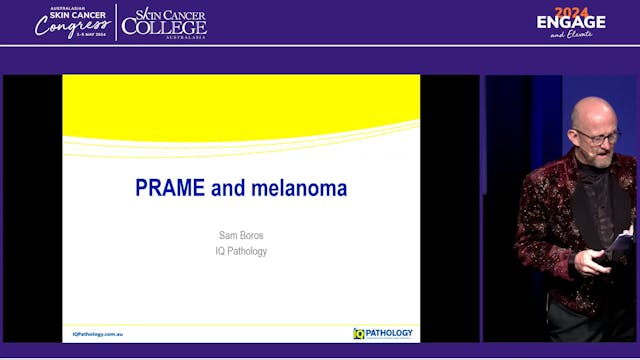 Does PRAME positive mean melanoma Dr ...