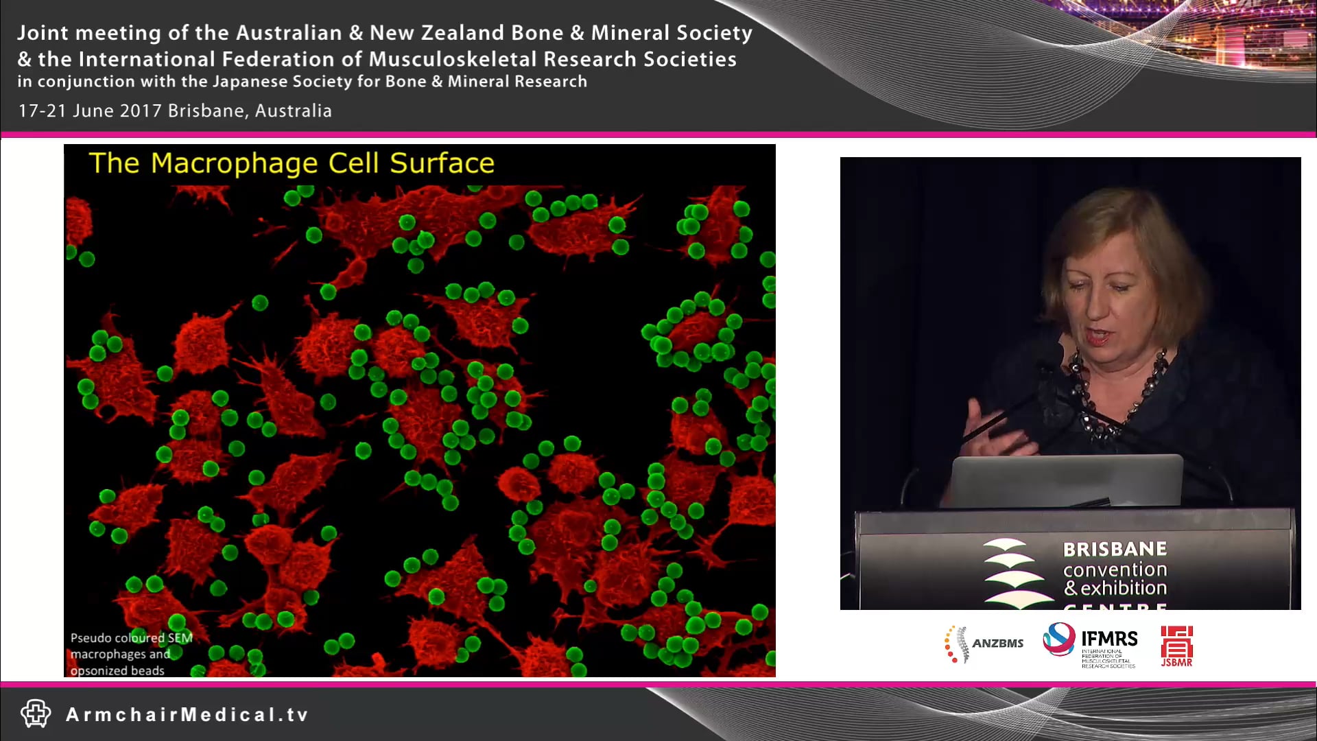 Imaging the macrophage surface Dorsal ruffling in a new light Prof Jennifer Stow