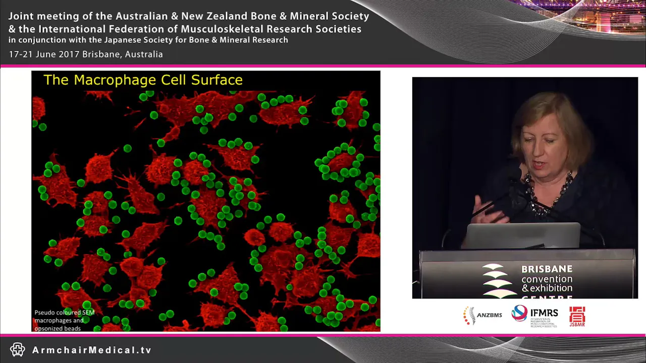 Imaging the macrophage surface Dorsal ruffling in a new light Prof ...