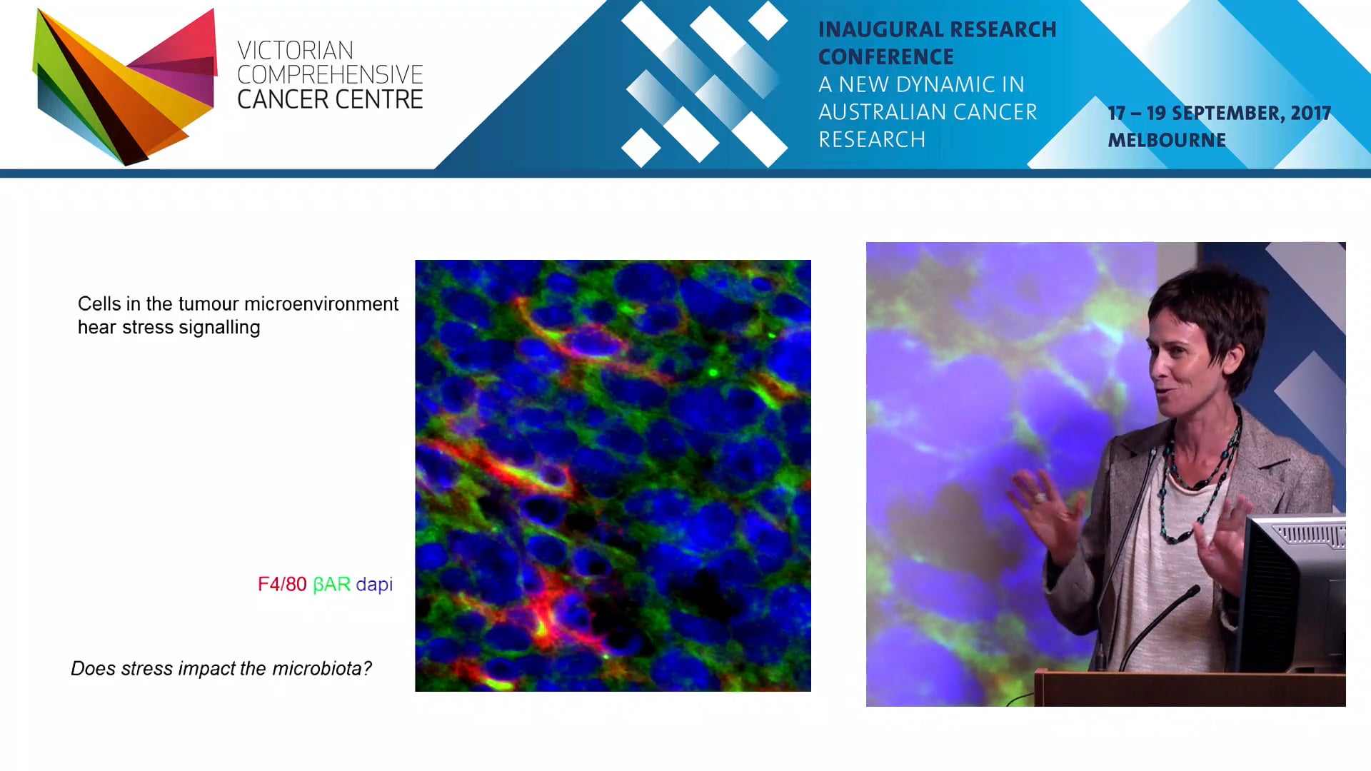 Stress remodels the tumour microenvironment  the impact on cancer progression - Erica Sloan