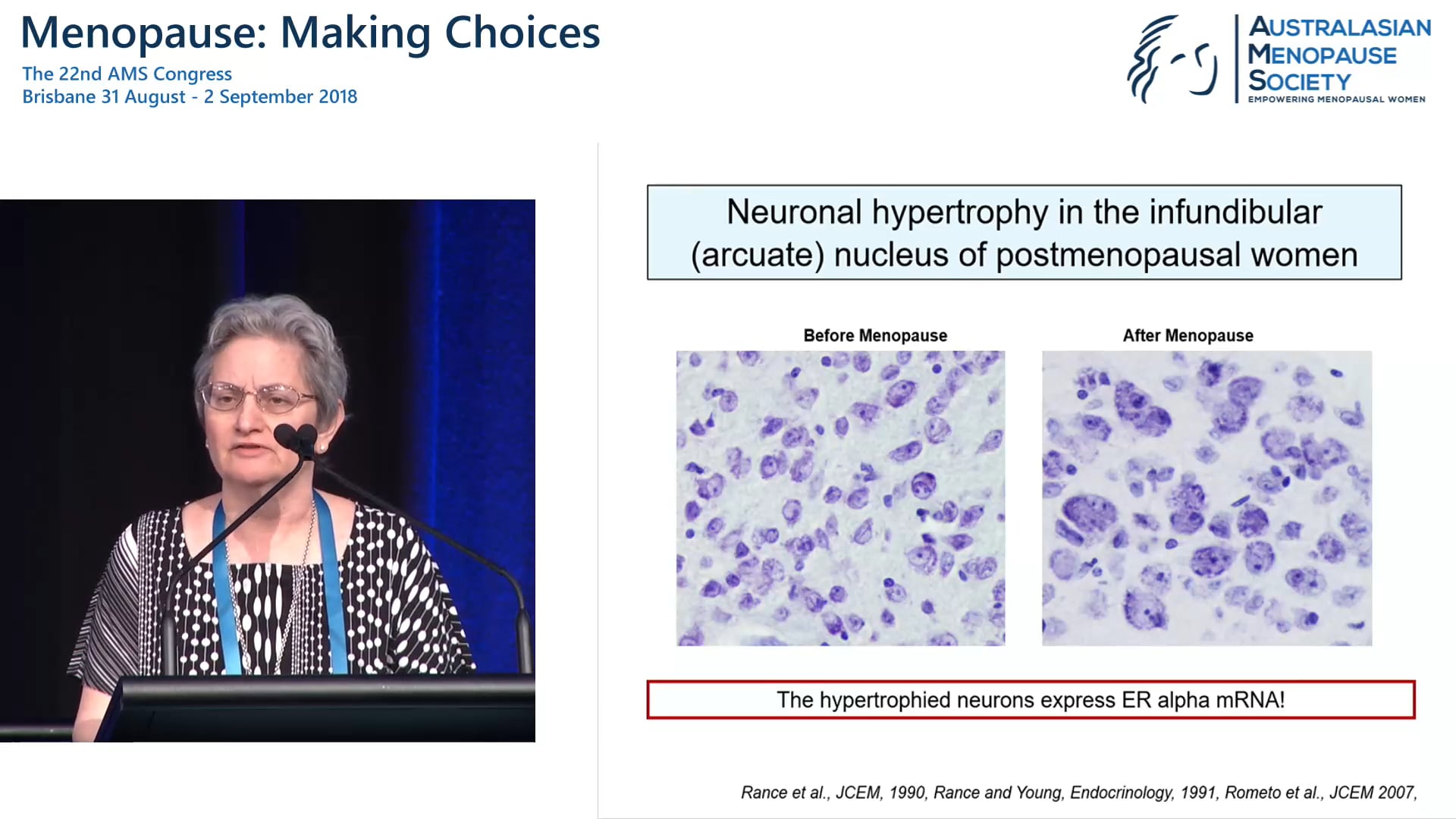 New advances in understanding the aetiology of hot flushes Prof Naomi Rance