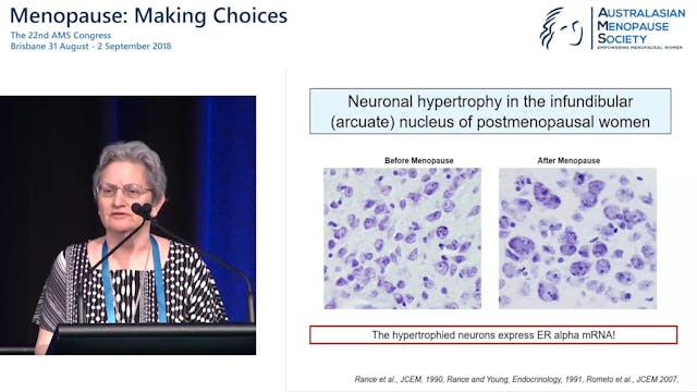 New advances in understanding the aet...