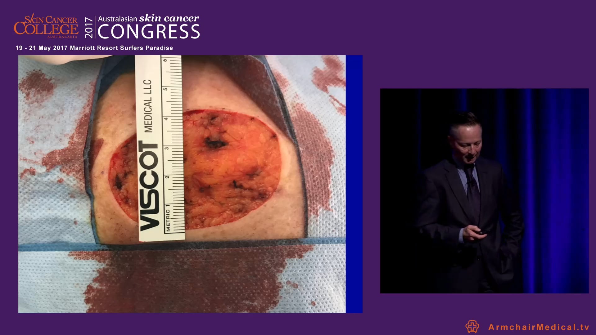 How to think like a plastic surgeon Dr Mark Gittos