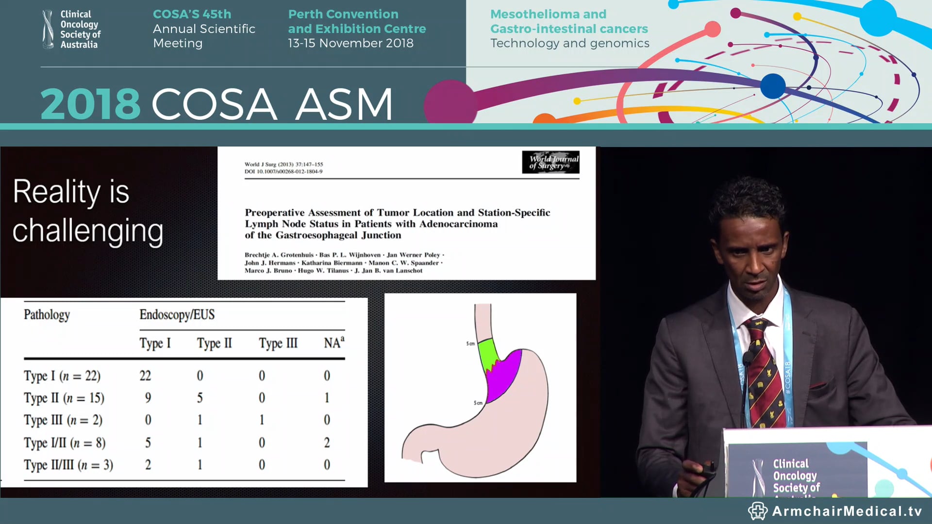 The Colliding Junction Surgical Options in GOJ AdenocarcinomaMohammed Ballal