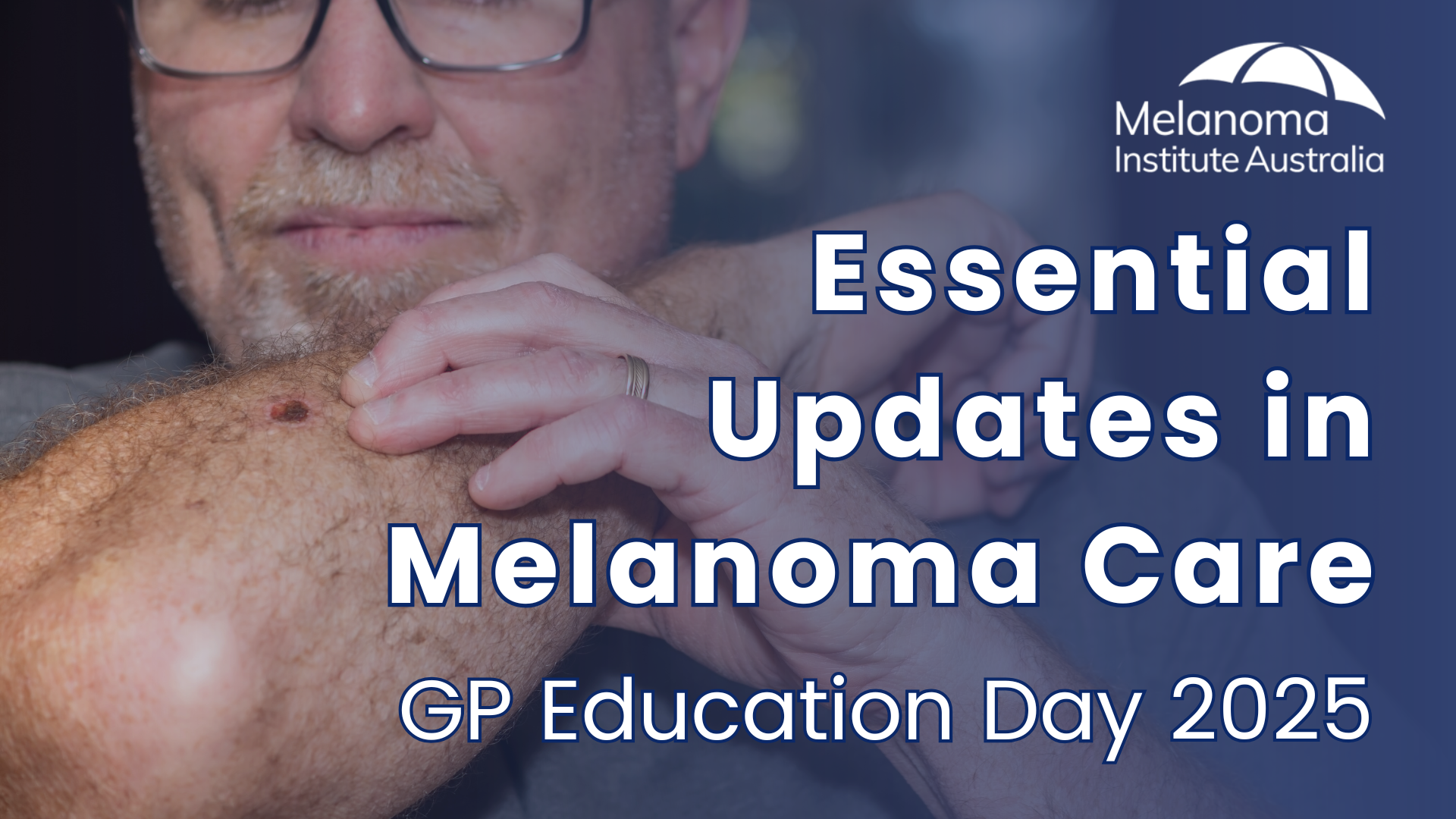 Essential Updates in Melanoma Care 2025