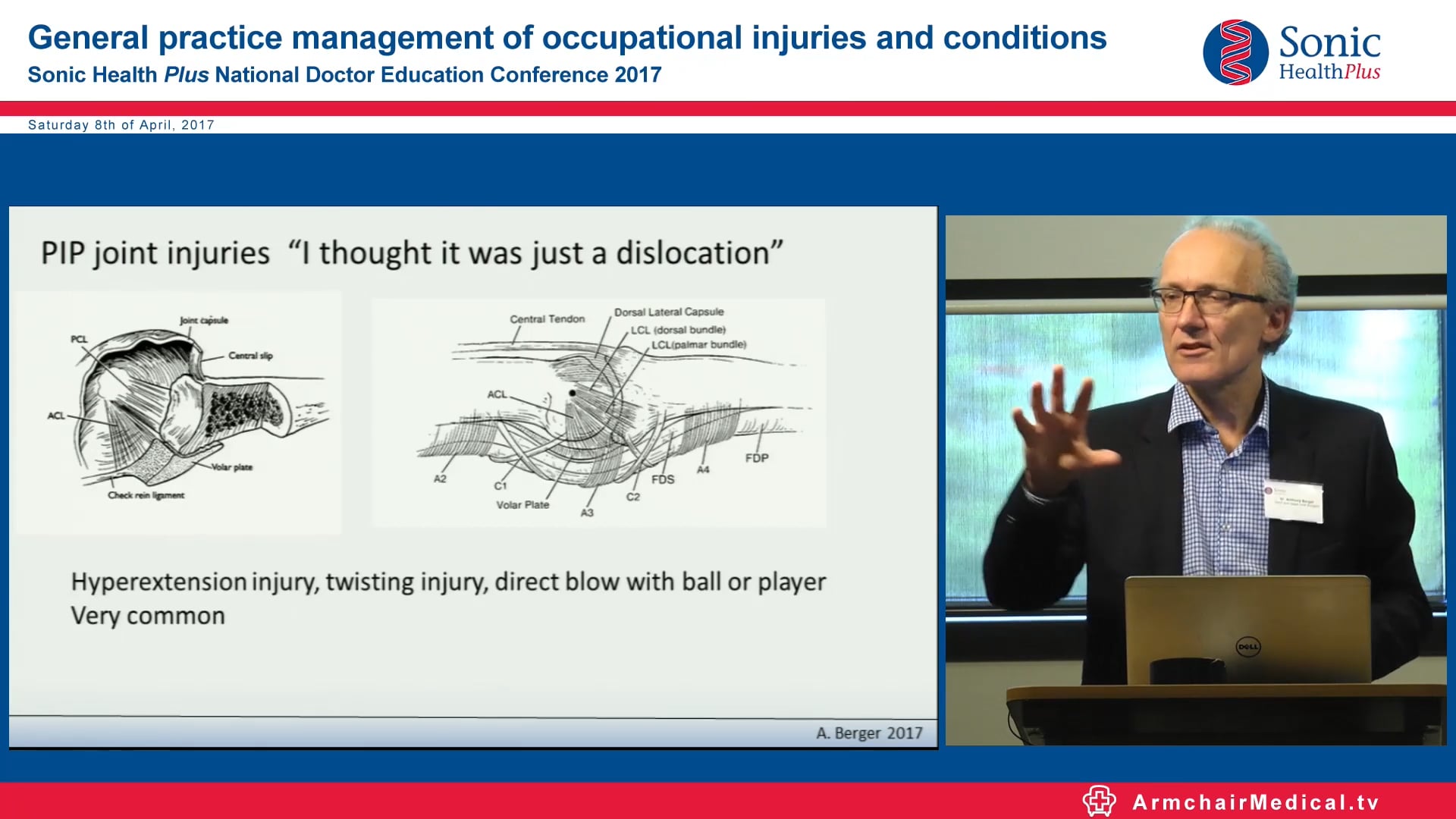 1 Common hand and wrist conditions Mr Anthony Berger