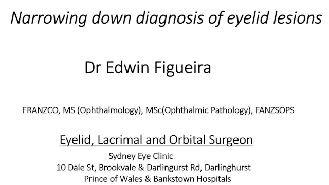 Narrowing down eye lid lesions Dr Edwin Figueira