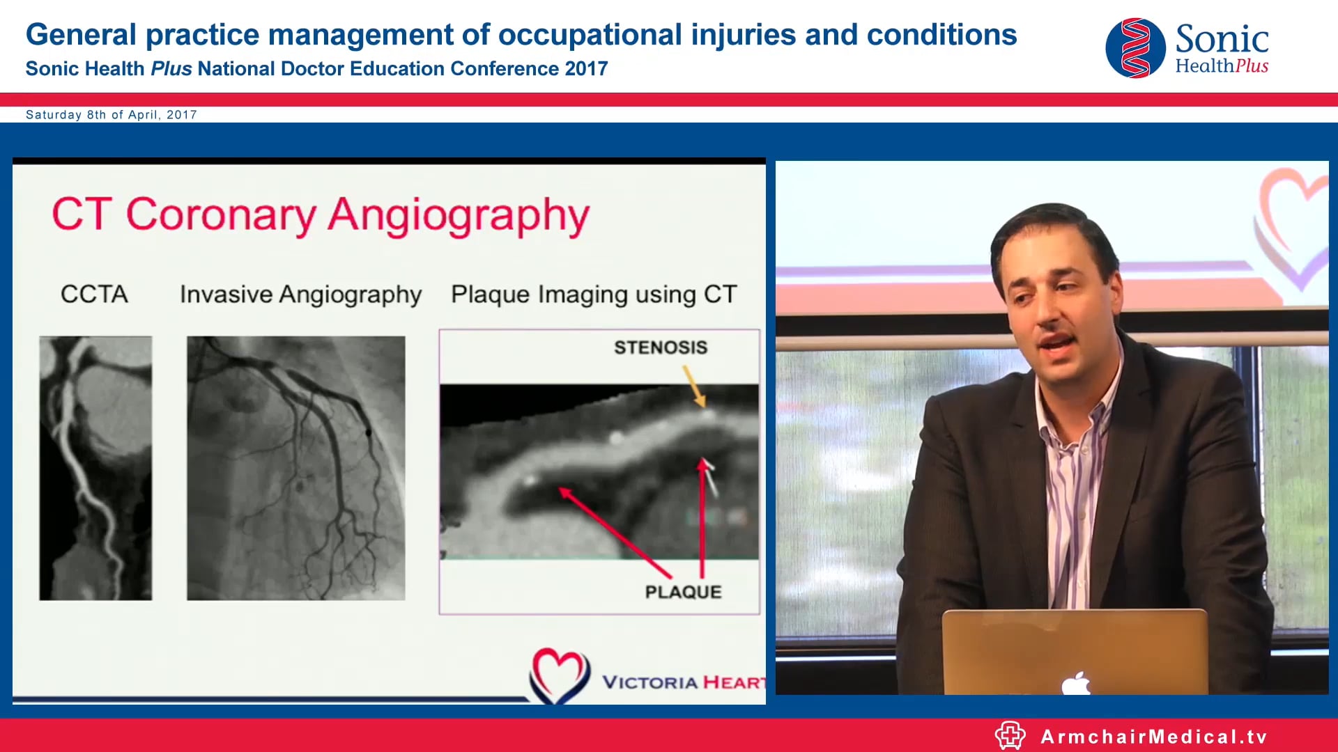 Working with a sick heart Assoc Prof Arthur Nasis