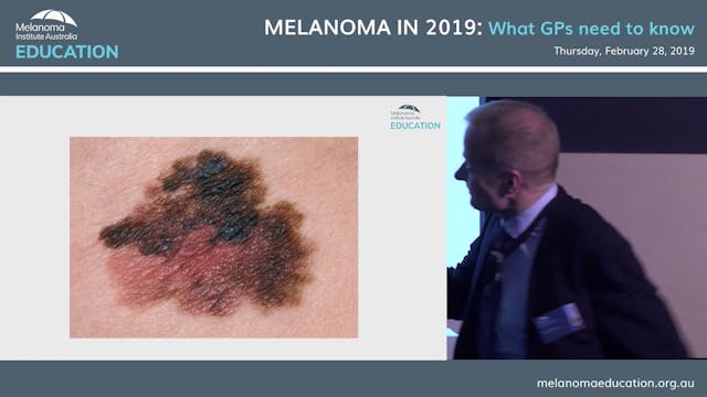 Melanoma diagnosis and staging A surv...