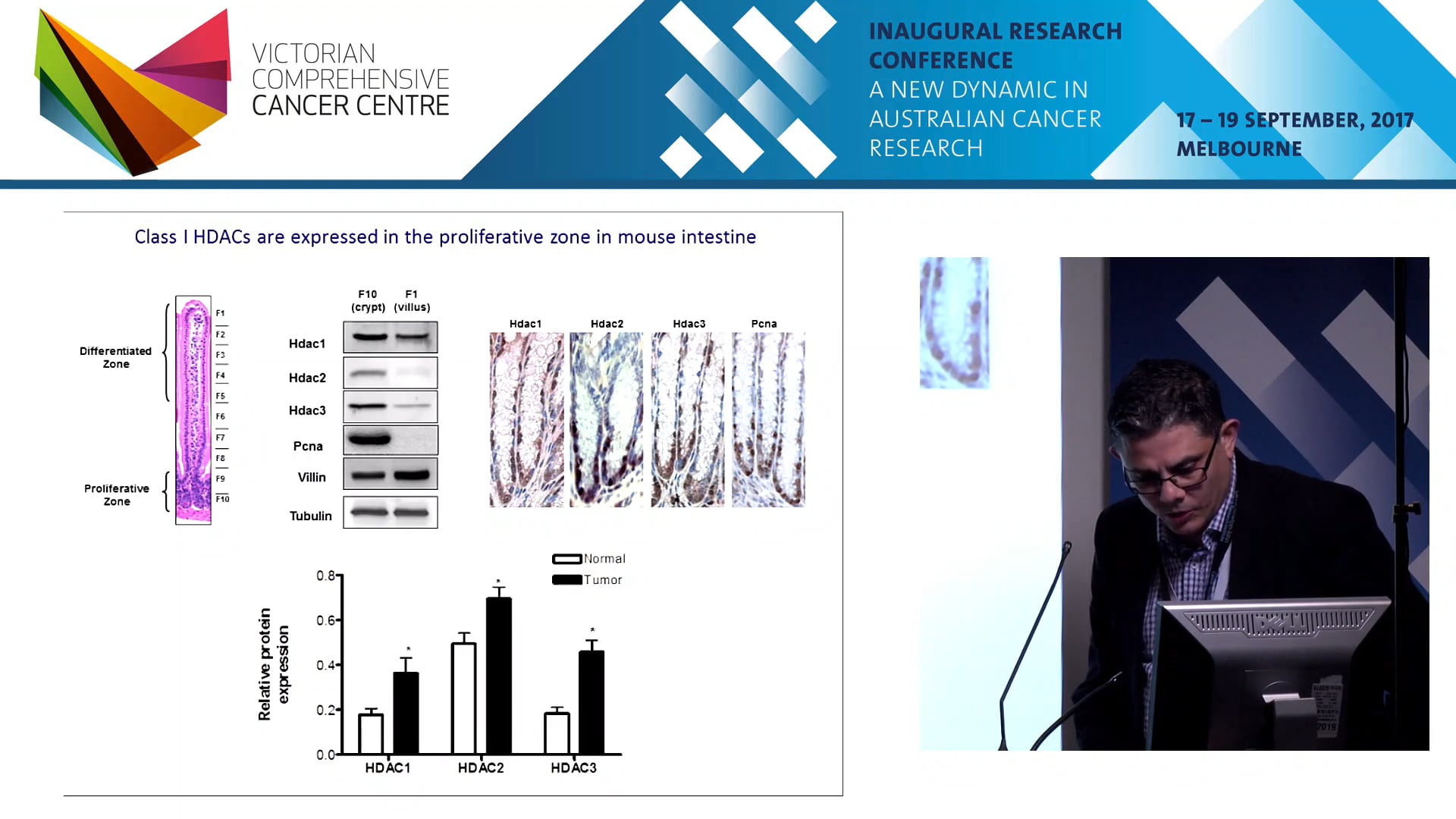 Hdac3 regulates lipid oxidation in the intestinal epithelium - Prof John Mariadason
