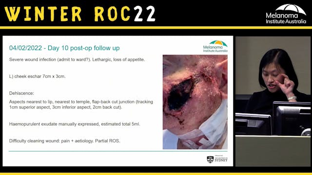 Post-op complications A series of cas...