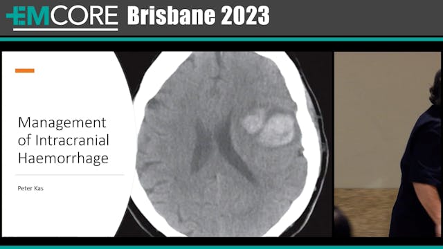 Intracranial Bleed Management Guideli...