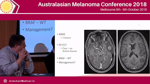 Brain and Leptomeningeal Meatastases Panel Discussion