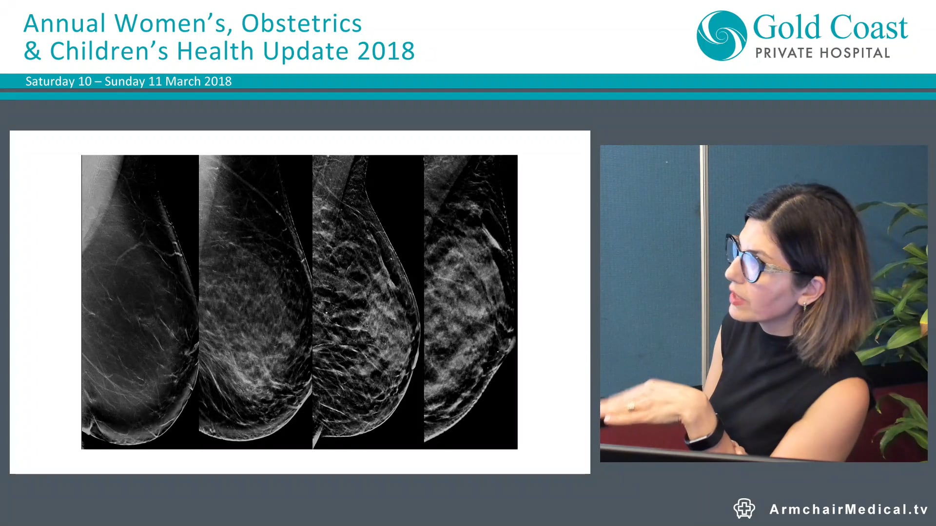 Breast Imaging Dr Shohreh Rezai, Radiologist (Queensland X-Ray)
