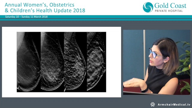 Breast Imaging Dr Shohreh Rezai, Radiologist (Queensland X-Ray)