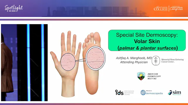 Dermoscopy Masterclass Volar Surfaces...