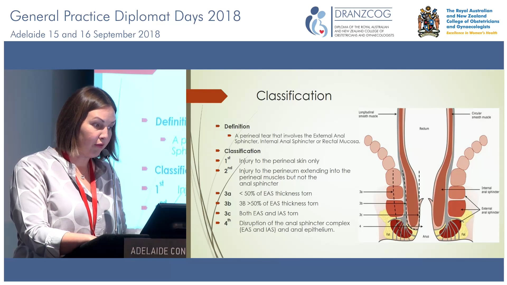 Obstetric anal sphincter injury Protecting nature's weak spot Dr Kate Walsh