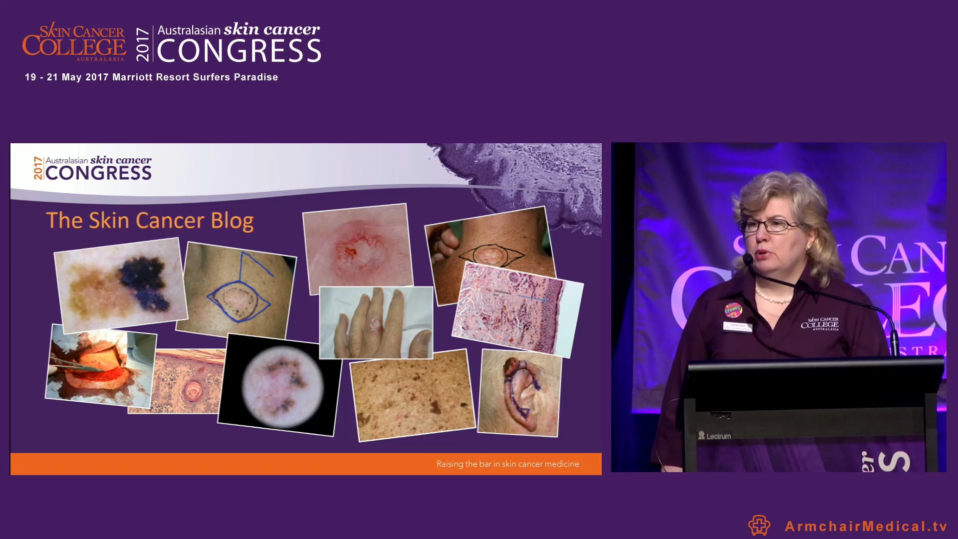 The Skin Cancer College Blog  Ms Lynette Hunt