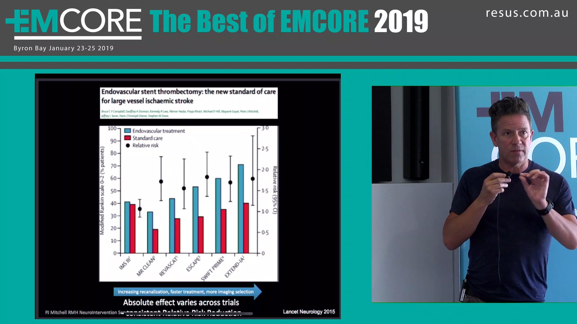 Endovascular treatment of actute ischaemic stroke Hal Rice