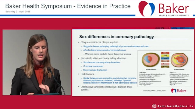Gender, Sex and Cardiovascular Disease Dr Anna Beale