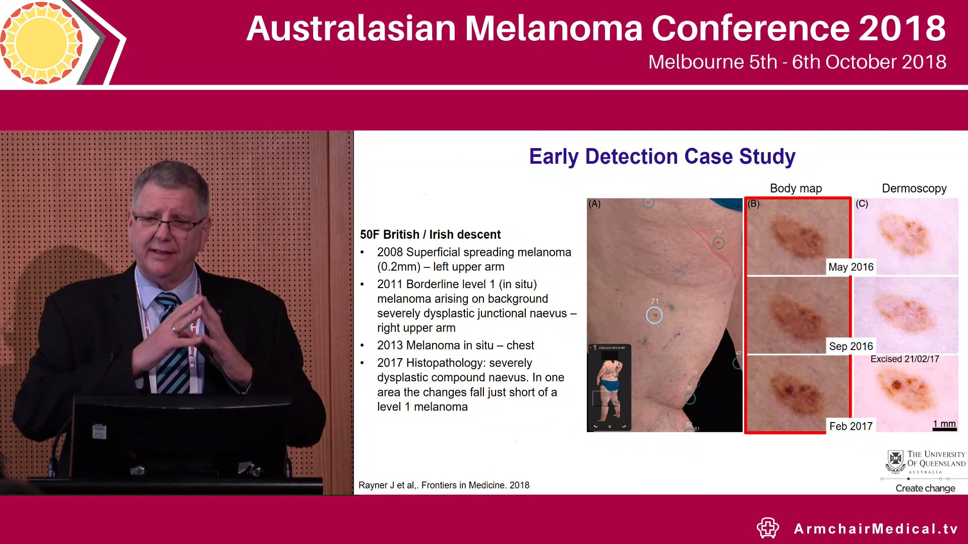 Early diagnosis using telemedicine and technology Peter Soyer