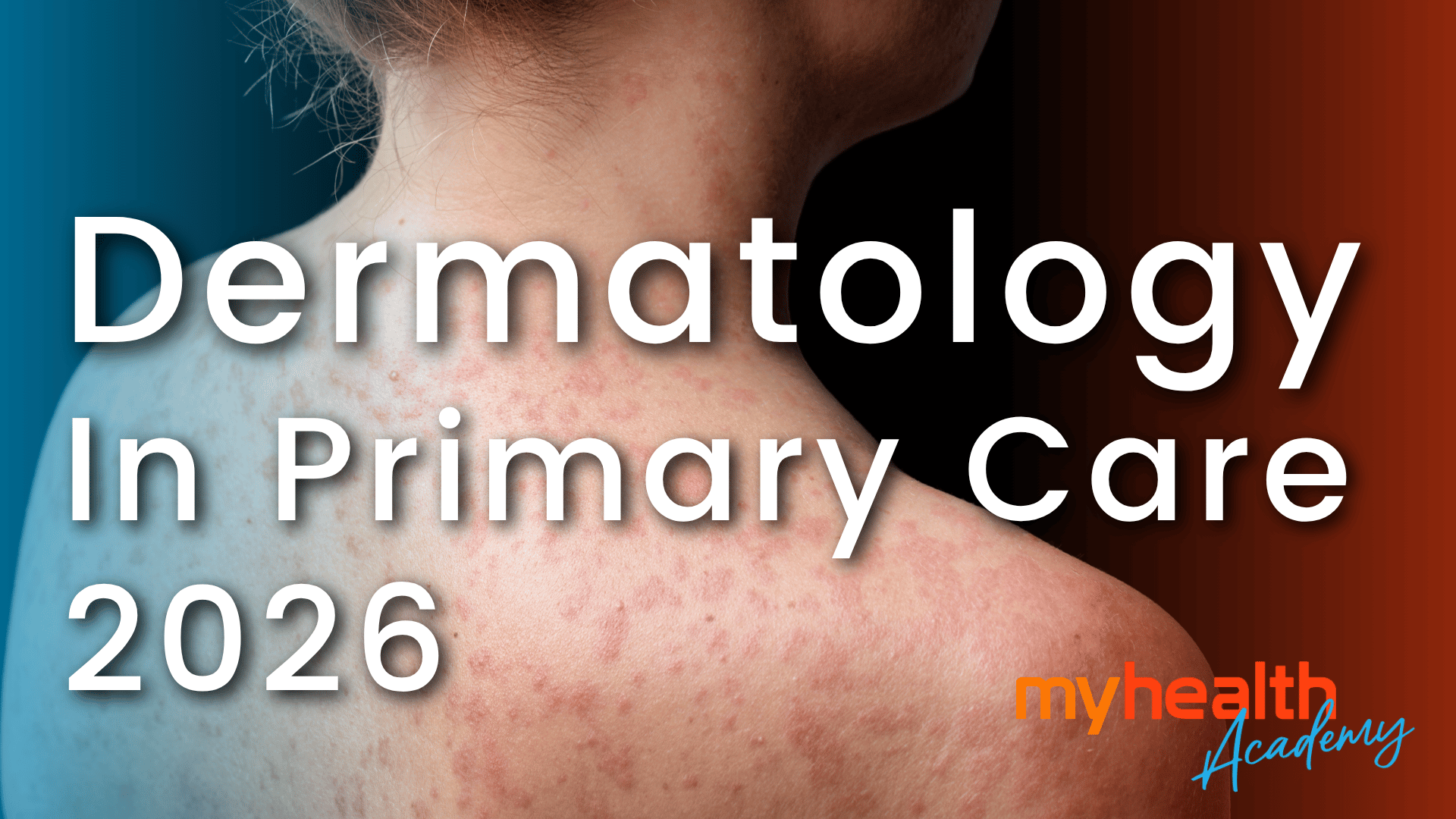 Dermatology in Primary Care