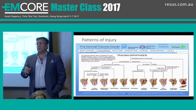 Dental Trauma Dr Will Davies