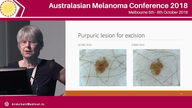 Long and short term sequential dermos...