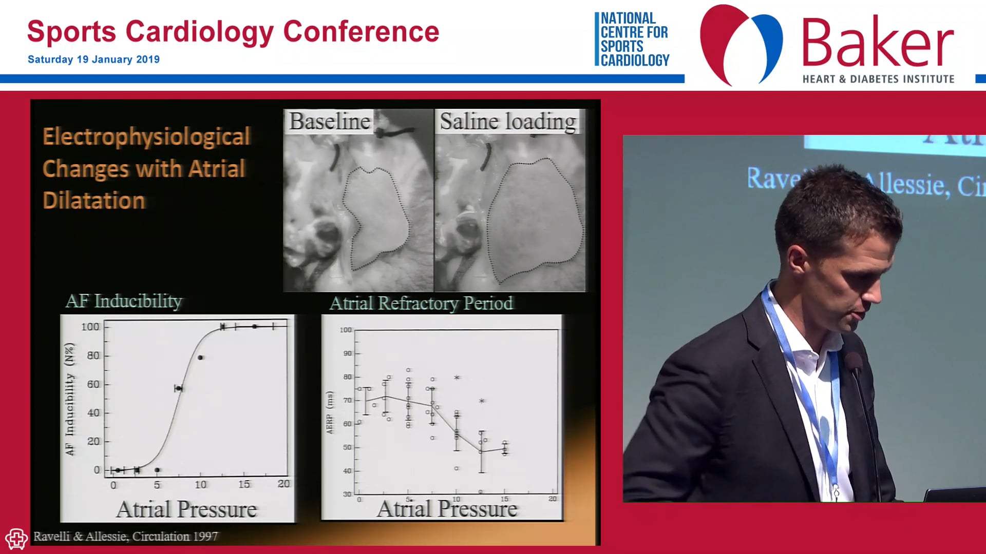 Too much exercise and AF Adrian Elliott