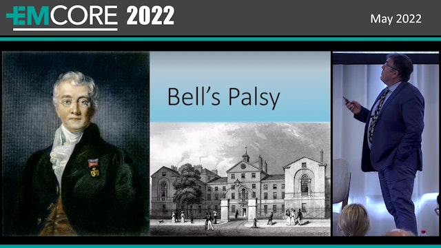 Bell's Palsy Will Davies