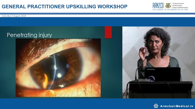 Eye Emergencies Dr Anne Mallat