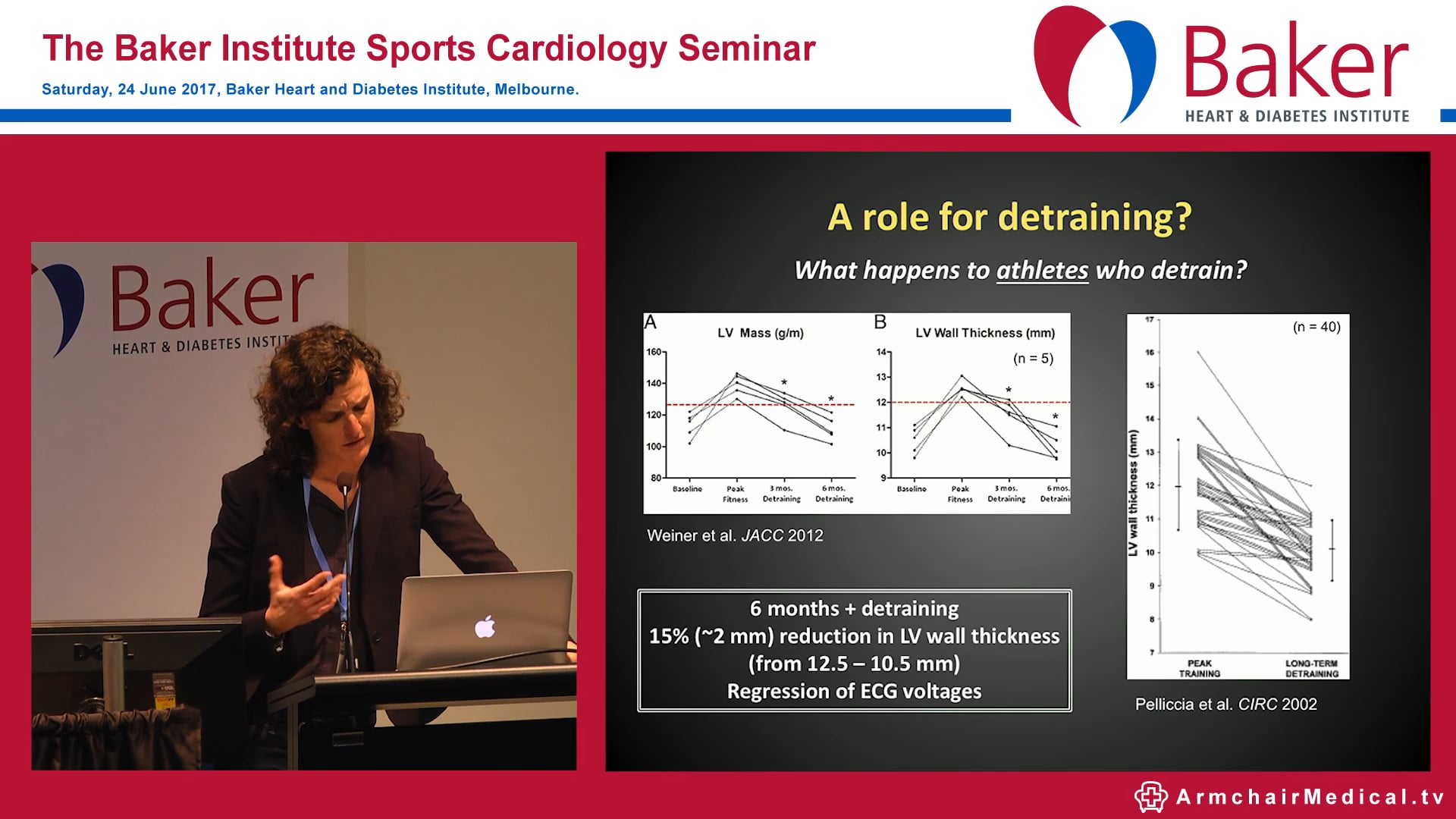 Hypertrophic cardiomyopathy or athletic LVH? Dr Maria Brosnan