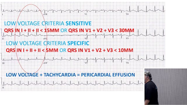 ECG Quiz Not For Publication