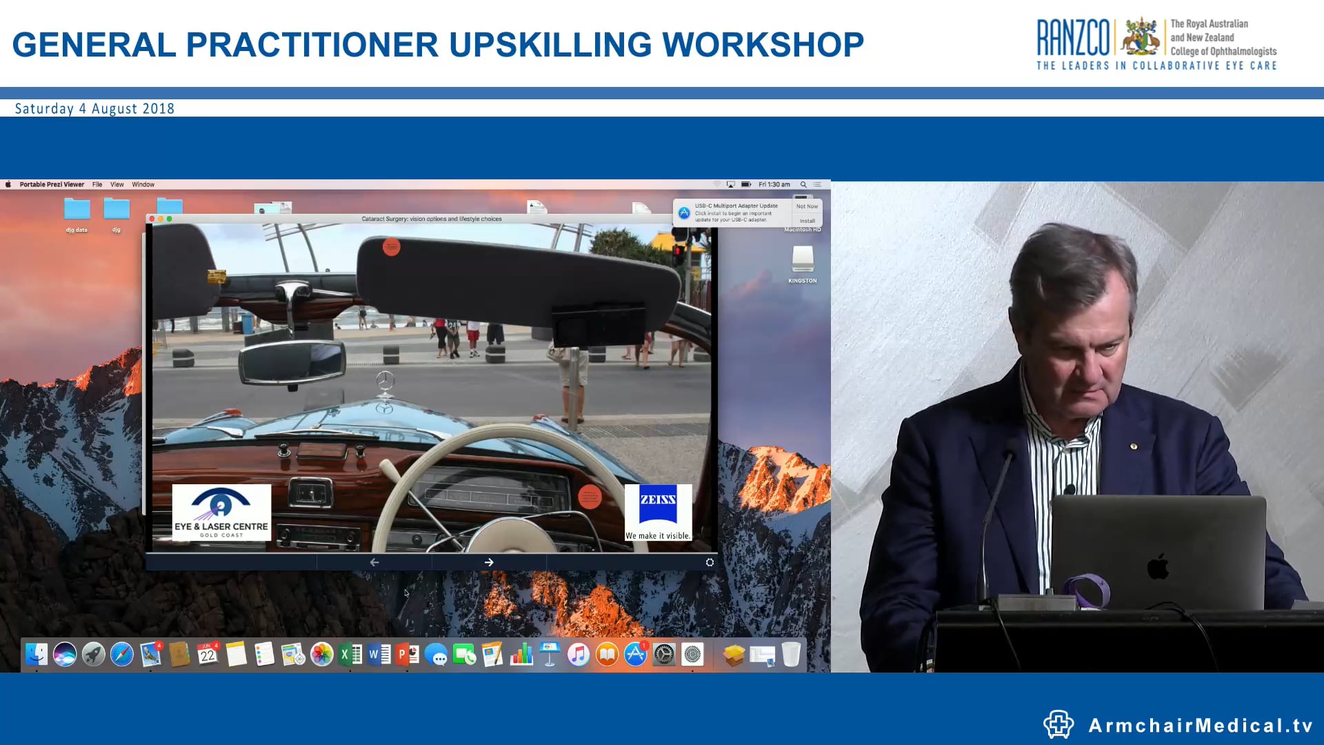 Cataract Surgery Vision options & lifestyle choices Dr Darryl Gregor