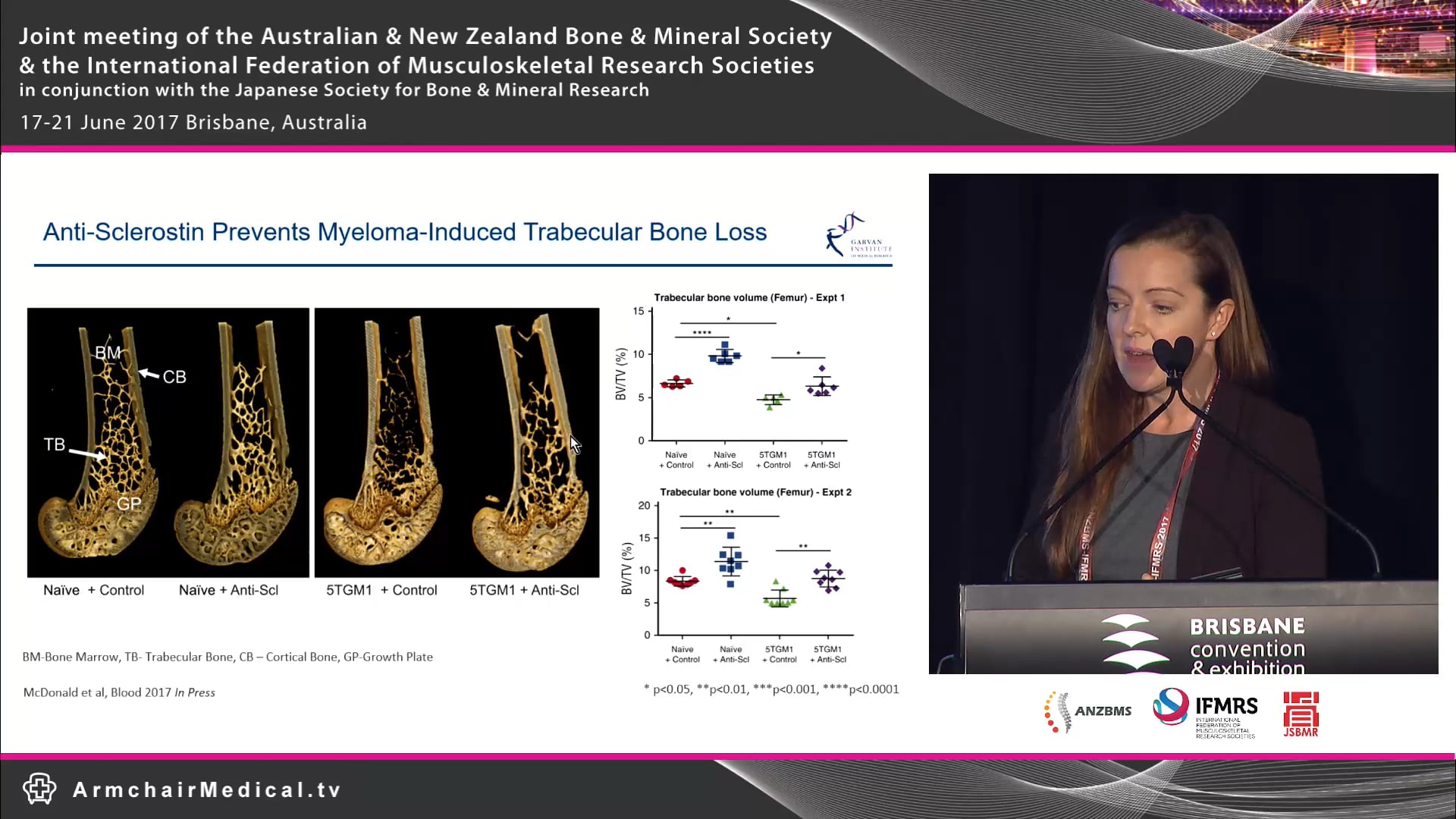 Anti-sclerostin antibody treatment prevents myeloma induced bone disease and increases bone strength Michelle Mc Donald